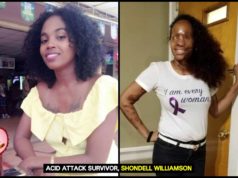 After two years and countless surgeries, acid attack survivor can now see