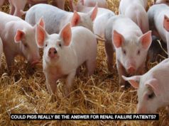 Researchers moving closer to human trials for pigs’ kidneys transplant