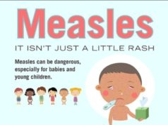 Improved service delivery to help prevent measles outbreaks
