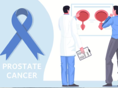 100 men to receive free screening for prostate cancer