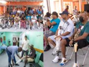 33 patients receive prosthetic limbs